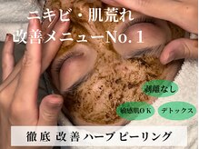 シアン(CYAN)の雰囲気（ハーブピーリング＝デトックス、ターンオーバー正常化、肌質改善）