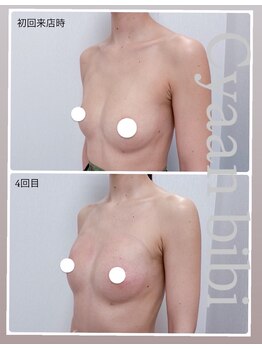 シアンビビ(Cyaan bibi)/プランプバスト