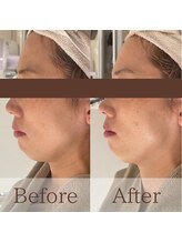 凪眠/小顔リンパフェイシャルの効果66