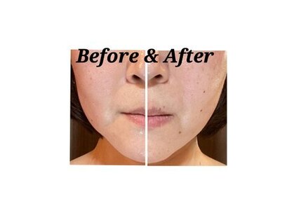 ヒーリングデトックス リラックリ(HealingDetox RELUCKRY)の写真