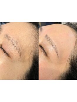 お肌をきれいにしたい