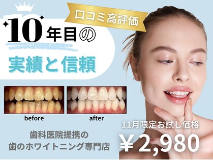 ホワイトニングショップ 所沢店の写真