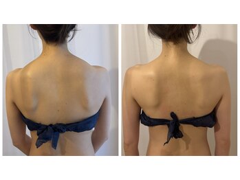 アエレ(AEREE retreat salon)/90分 背中・首筋のはり・肩甲骨