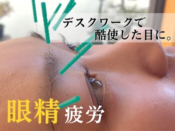 栄光治院 岡崎本院/【眼精疲労】がある方必見!!