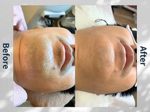 アンフルール(Une fleur)