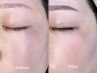 New!!【ツヤ肌WAX】全顔+眉毛〔鎮静パック付き〕11000→9000