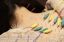 リセット鍼灸院(Risetto鍼灸院)