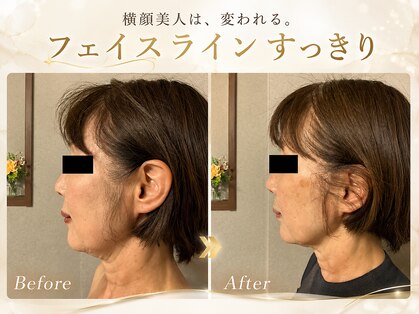 ルリエ(Relier)の写真