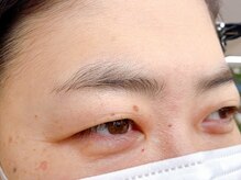 ブロンズアイ(BRONZE EYE)/アイブロウ【施術前】