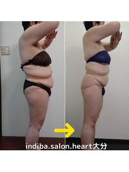 ハート 大分(heart)/108キロが60キロに!驚きます!!