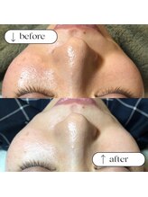 トータルビューティーサロンリア(Li'a)/ビフォー＆アフター