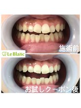 ルブラン 奈良店(Le Blanc)/美に欠かせない！！