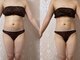 サロンドボーテ ノンノン(Salon de Beaute Non-non)の写真