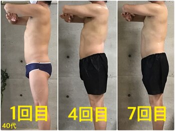 ペリー(PELLY)/男性40代 before after