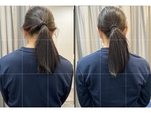 かわさき整体院/30代女性ビフォーアフター