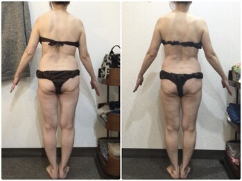 美容整体ウェリナ 名駅院/小顔矯正/骨盤矯正/美脚サロン