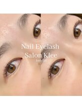 クレー(Klee)/ラッシュリフト