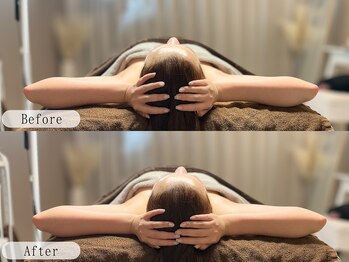 ルルミリ 心斎橋(Lulumili)/たるみ小顔矯正ケア