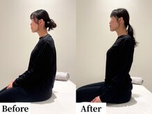 ソレア(Solea)/結婚式に向けての姿勢改善1回目