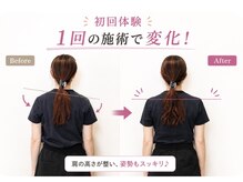 リフェイス(RE:FACE)の雰囲気（肩の高さが整い姿勢もスッキリ♪）