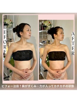 蒼(so)/頑固な首こり・肩こりが解消!