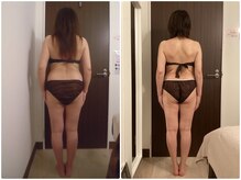 グレイスボディ BiViつくば店(Grace Body)/◆痩身　症例写真