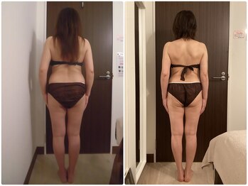 グレイスボディ BiViつくば店(Grace Body)/◆痩身　症例写真