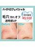 毛穴汚れオフ！ハイドロ毛穴洗浄！8,800円→5,500円