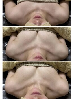 ルアナスタイル(Luana style)/