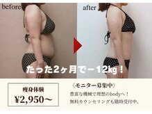 アップ ケリー 筑紫野店(up・kery)