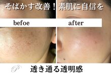 パールホワイトニングサロン 町田店