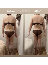 WA ネイル アンド ビューティー(WA nail & beauty)/痩身リンパ　全身