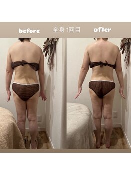 WA ネイル アンド ビューティー(WA nail & beauty)/痩身リンパ　全身