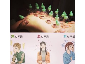 エステティックサロン ビエラブ(bierabu)/【オプション】背中カッピング