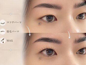オンニ(onni)/