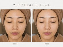ルフ エステティック ビューティー(ruf esthetic beauty)の雰囲気（肌を育てて、透明感のある素肌へ。）