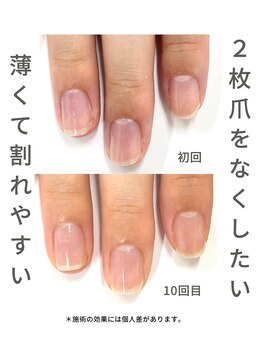 最強ネイルケア