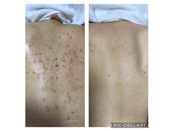 オアジスパ(Oasi Spa)