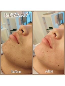 ココ(KoKo)/高校生も青髭はいやだよね