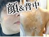 【背中＆お顔の2部位】剥離ありリベルハーブピーリング6千円商品券付￥44000