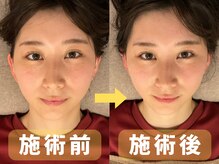 チアーライフ整体/小顔矯正＋骨盤矯正でお悩み改善