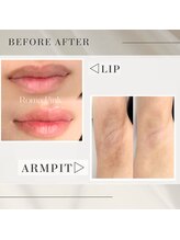 ソイ(Soi)/最新黒ずみケアのローマピンク！