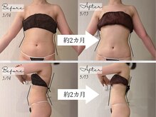 サイバーエステ 宇都宮店