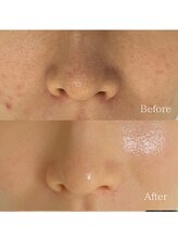 メイス 福井店(MEIS)/お客様before、after