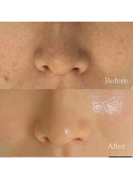 メイス 福井店(MEIS)/お客様before、after