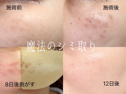 カルム(Calme)の写真