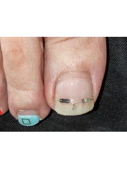 爪の悩みを解消できる（ケア含む）