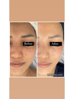 アズリー ルナ(AzRee Luna)/リアボーテハーブトリートメント