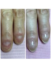 ネイルサロン キュービット(Q-bit)/