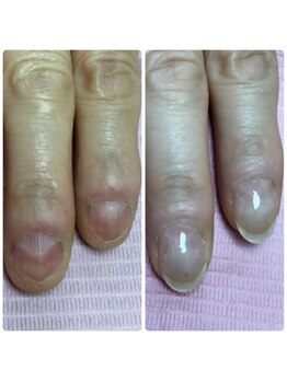 ネイルサロン キュービット(Q-bit)/